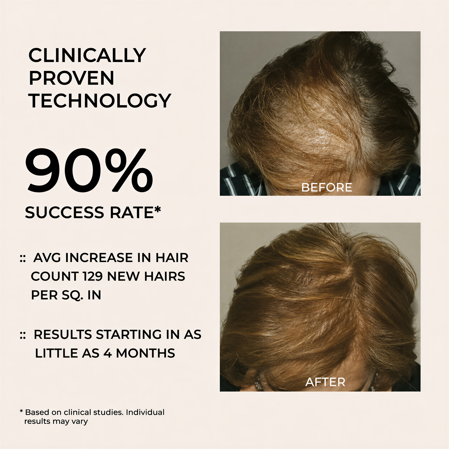ReviveCap™ — Red Light Therapy Cap