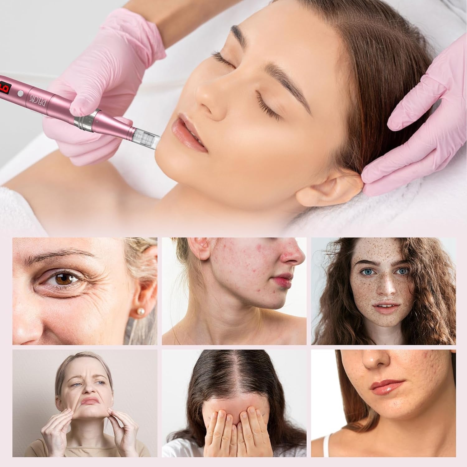 Dermapen Electric Microneedling Pen Rechargeable with 12 Needles for Wrinkles Stretch Marks Acnee Scar 0-2 Mm Adjustable 3 Speeds – Grey